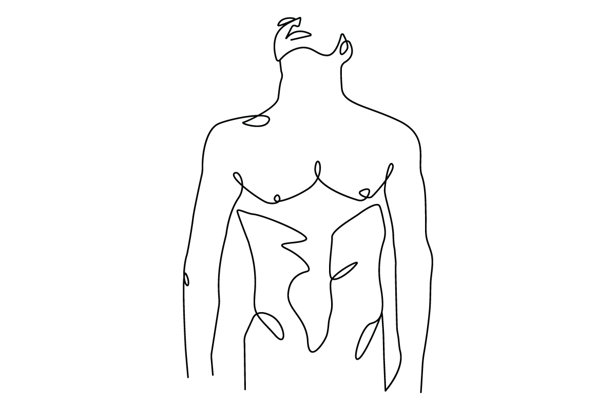 Frenuloplasty treatment illustration for cosmetic improvement