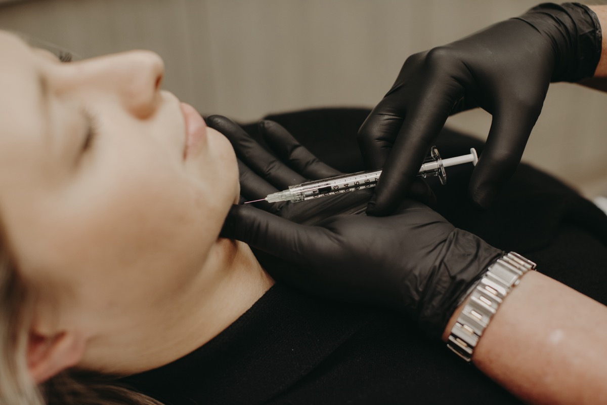 PDO Threads Skin Rejuvenation Treatment