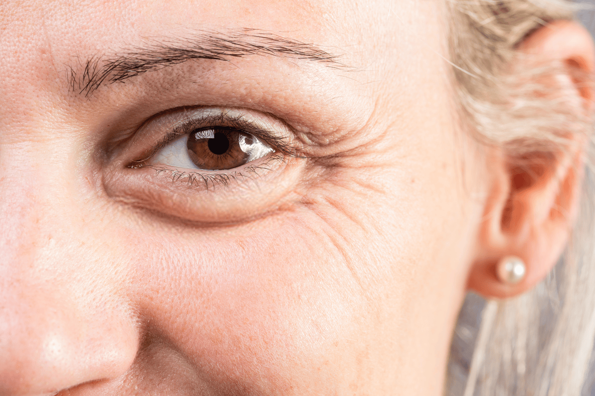 Solutions for fine lines and wrinkles offered at Academy Face and Body