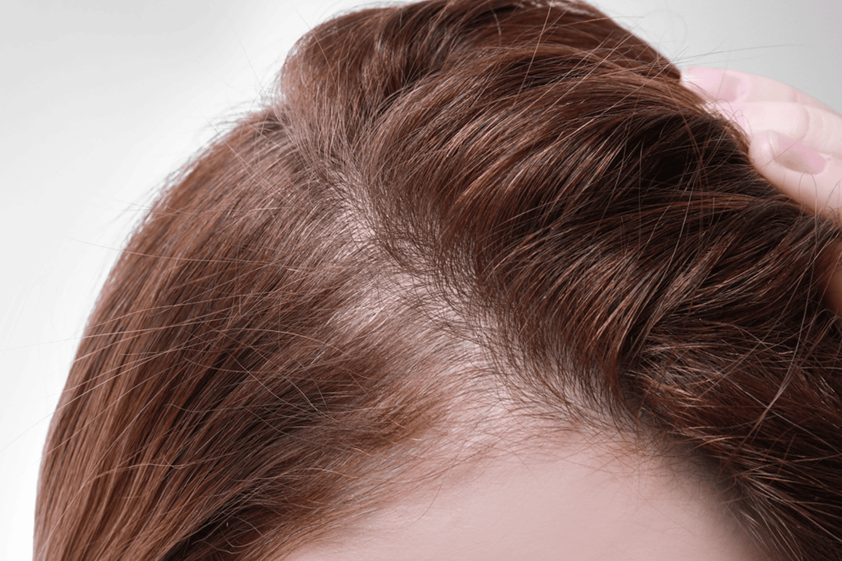 Academy Face and Body Hair Loss Treatment