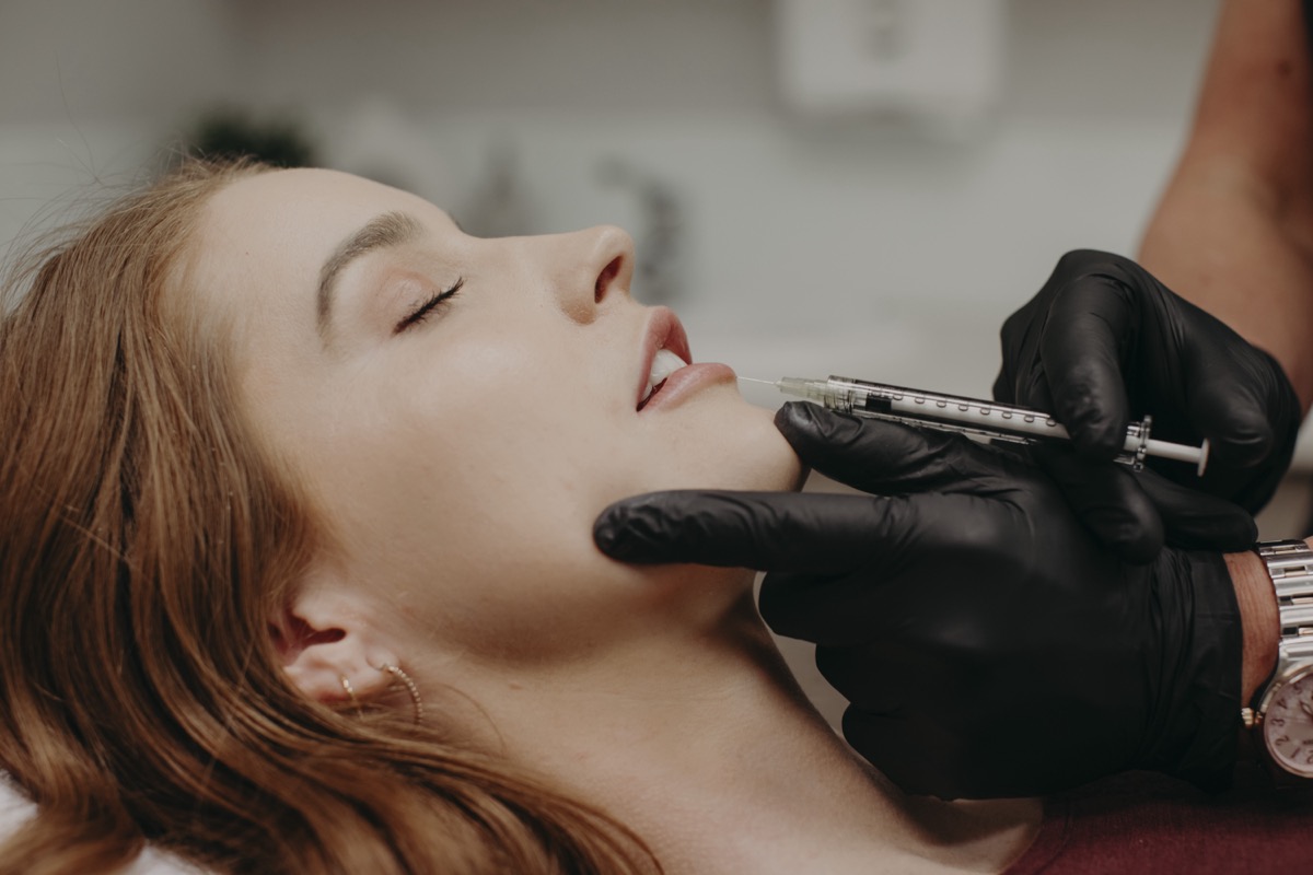 academy face and body lip filler 1