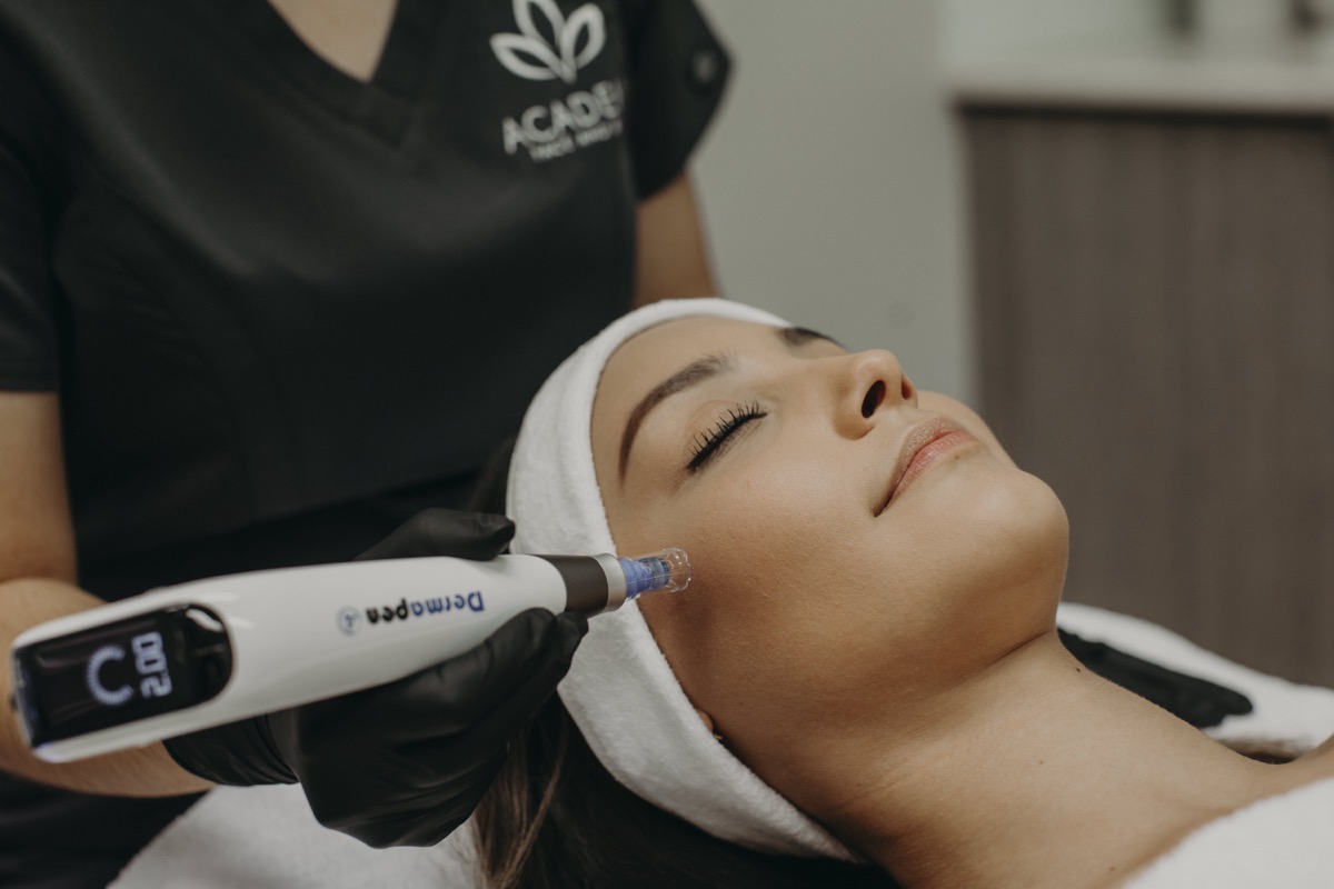 academy face and body microneedling