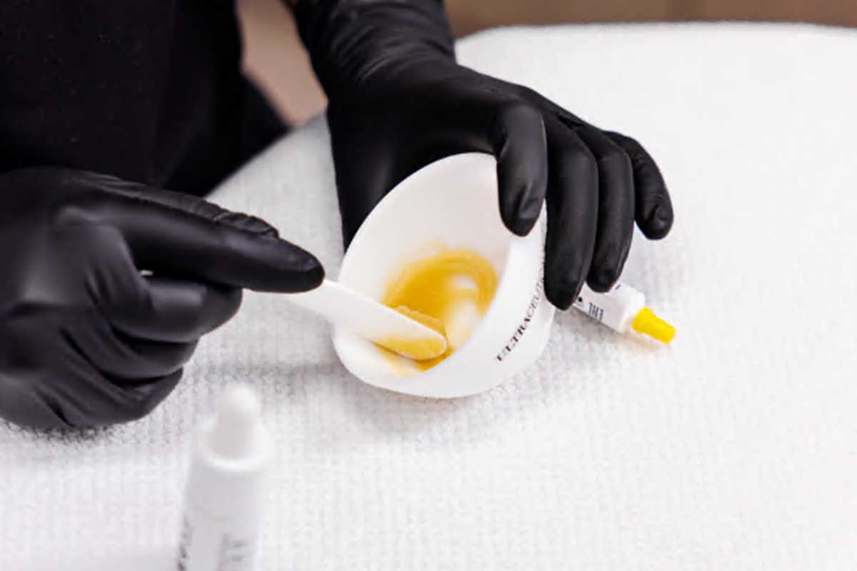 Clinical peels treatment at Academy Face and Body Perth