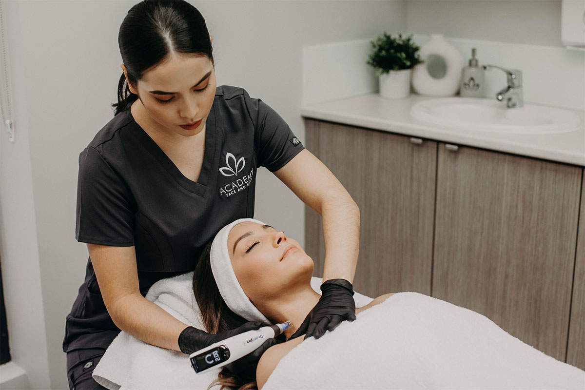 academy face and body microneedling treatment perth 1200x800 1